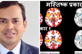 अमेरिकामा नेपाली वैज्ञानिकले पत्ता लगाए मस्तिष्क सम्बन्धी अर्को रोगको प्रकार ‘स्किजोफ्रेनिया’