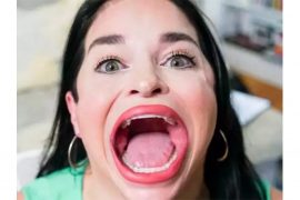 अमेरिकाकी यी महिला ठुलो आकारमा मुख फट्याएर विश्व रेकर्ड बनाइन