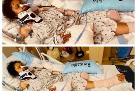 अमेरिकाको मेरिल्यान्डमा सवारीले ठक्कर दिदा अर्चना रेग्मी गंभीर घाइते