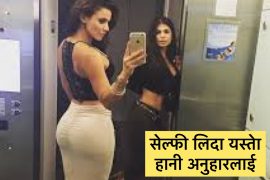 मोवाइल सेल्फी लतले यसरी बिर्गाछ अनुहारको सुन्दरता